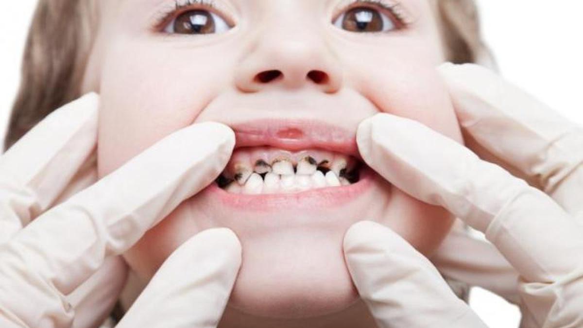 Ciri-ciri Kesehatan Mulut Anak yang Terjaga